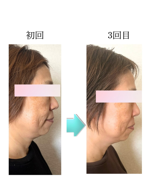画像362